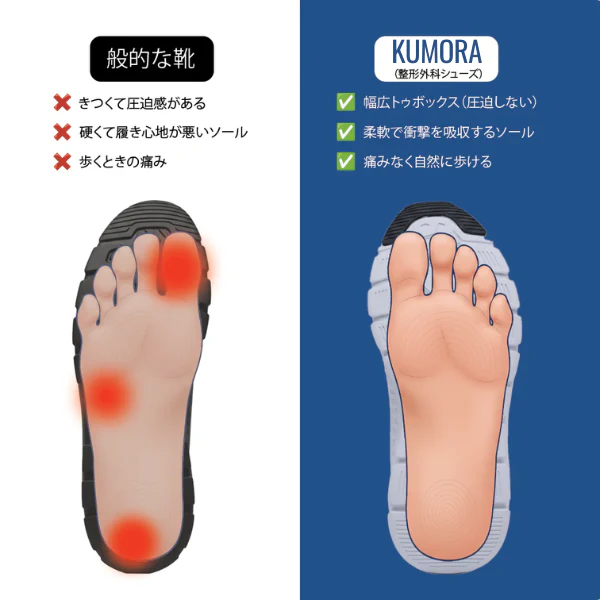 正しい靴の3つの条件